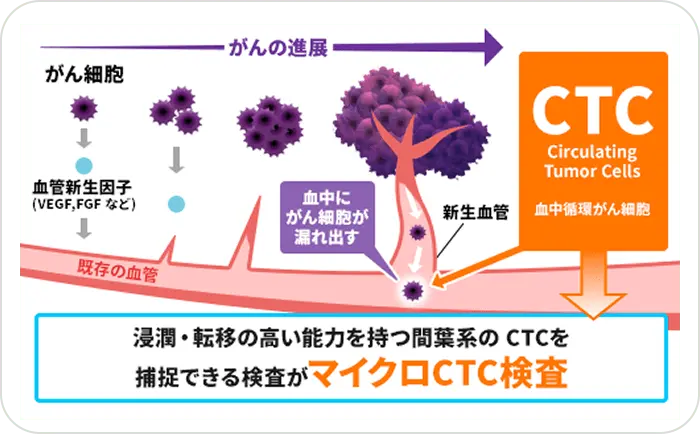 CTCとは
