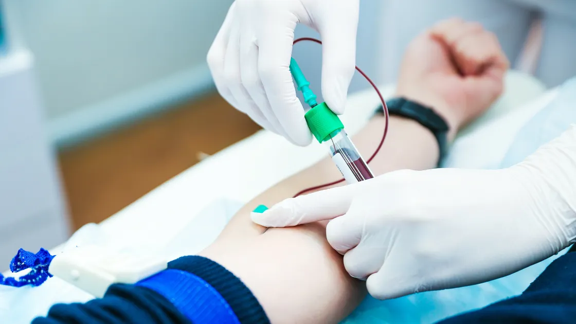 採血のみの検査