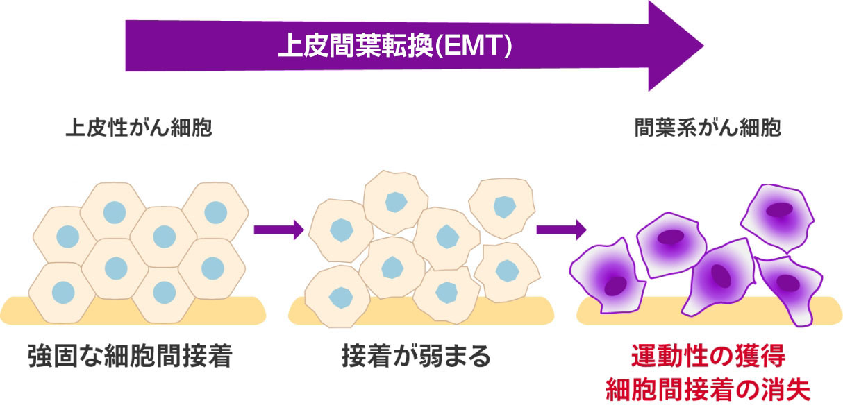 EMTが進行しがん細胞は間葉系へと悪性化していく