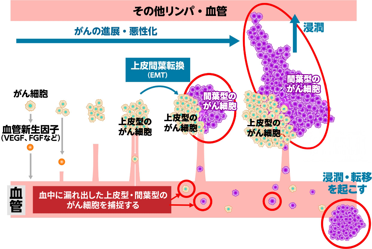マイクロCTC検査は上皮間葉転換したCTCだけを捕捉