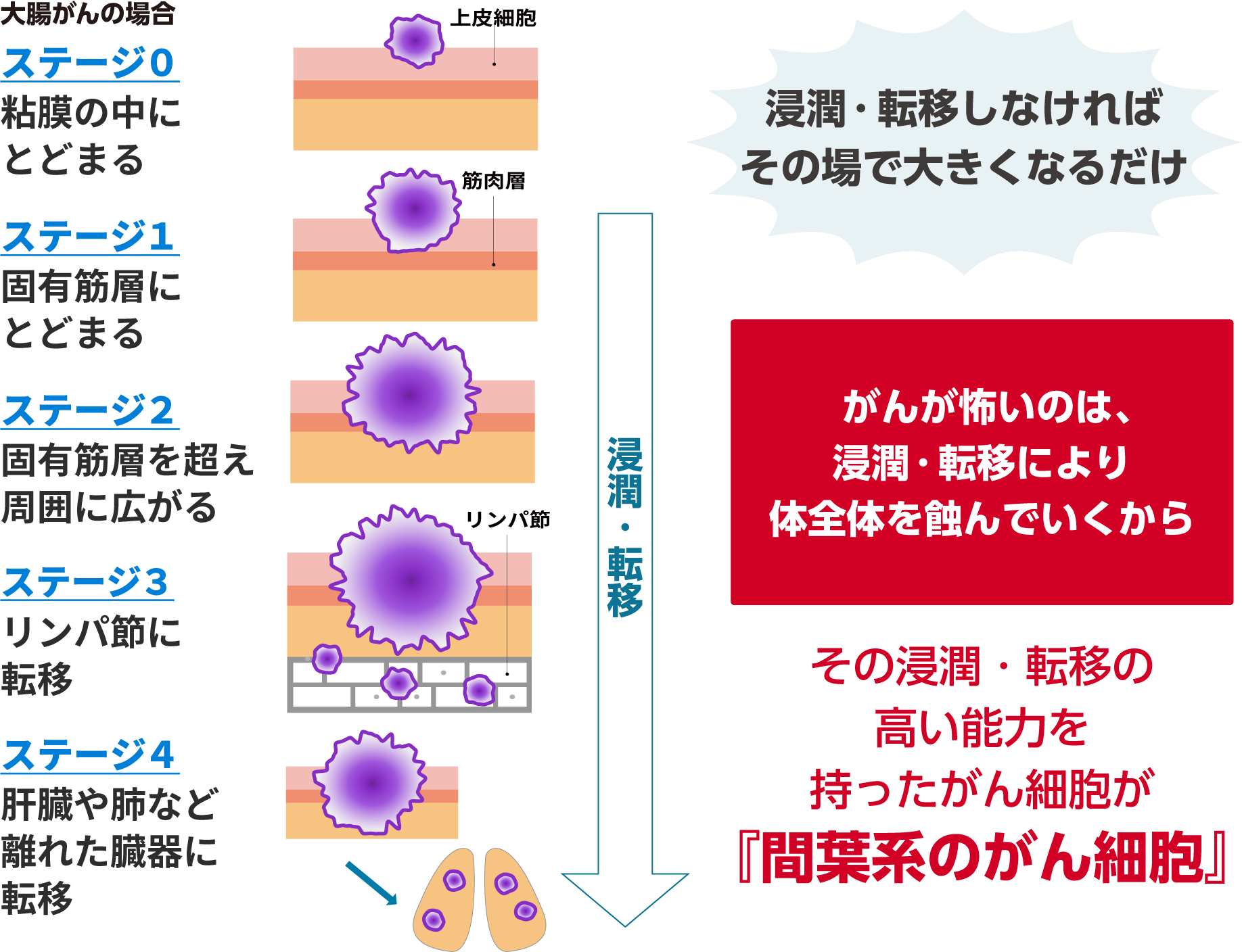 がんのステージ分類