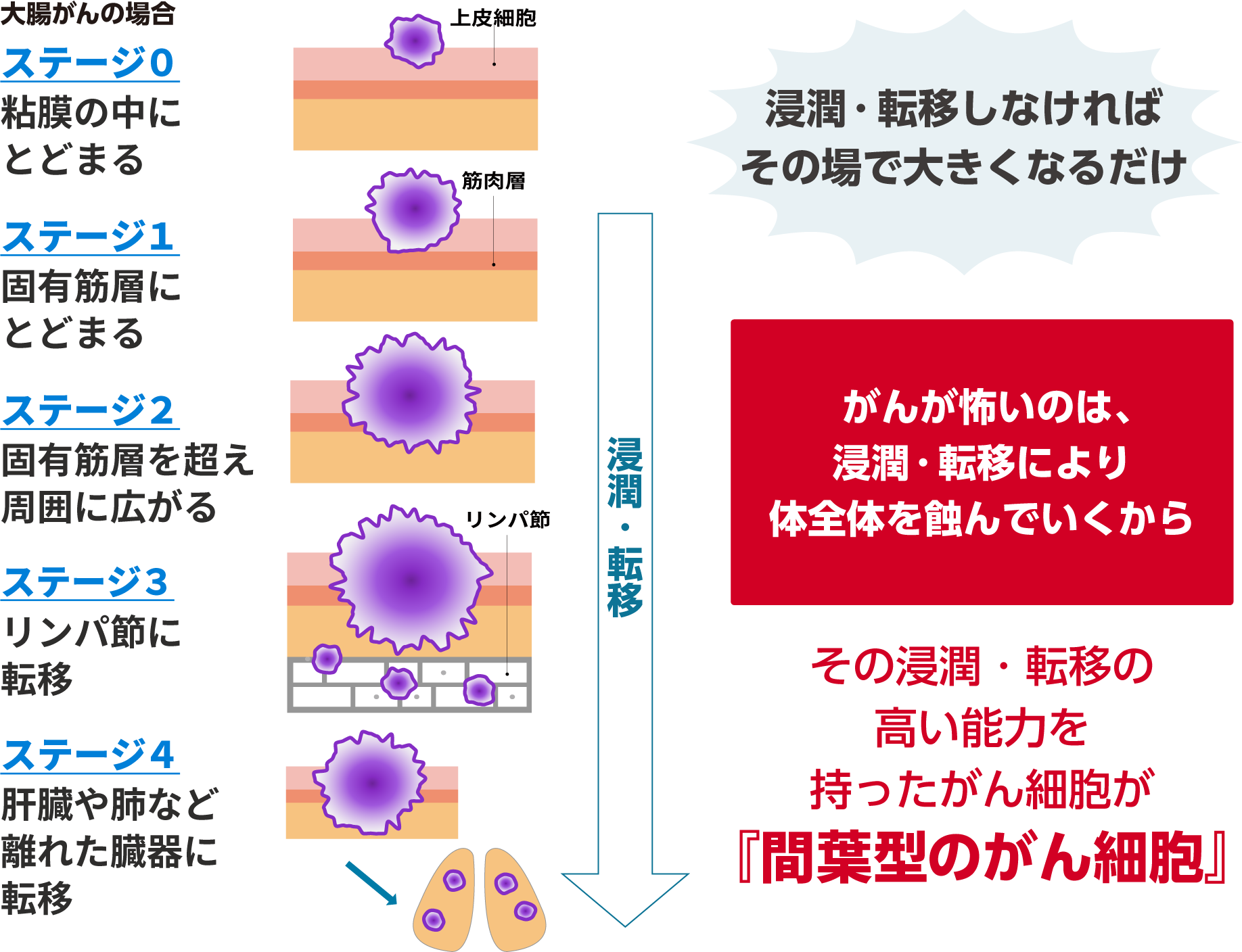 がんのステージ分類